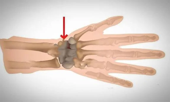 Delicate Touches in Hand and Wrist Health: Hand Surgery and Modern Microsurgery Applications