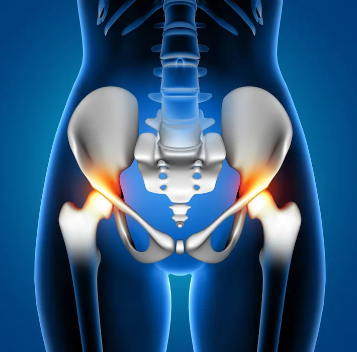 Hip Dislocation Treatment in Infants and Children: From Early Diagnosis to Current Surgical Methods