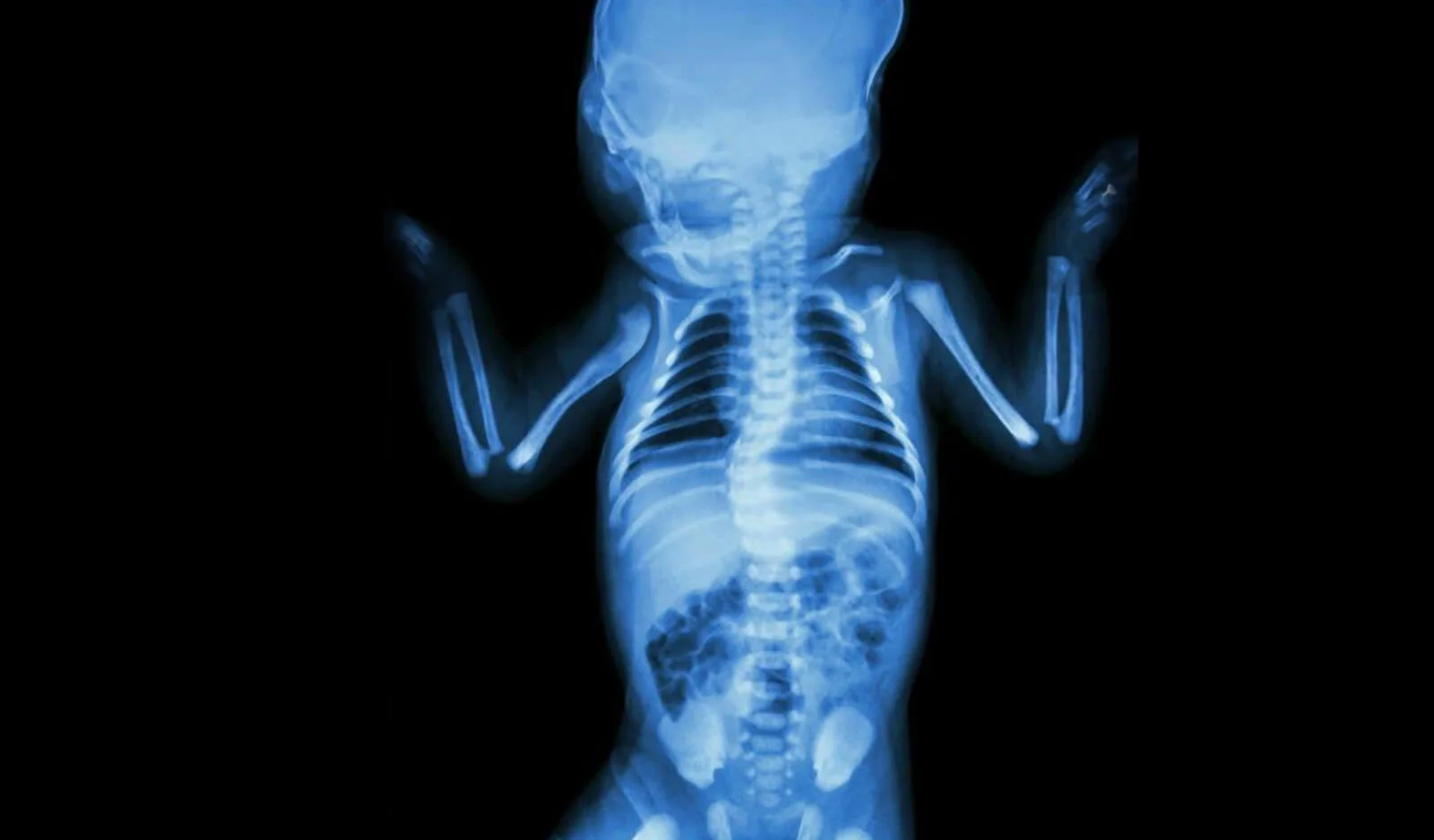 Other Congenital Anomalies